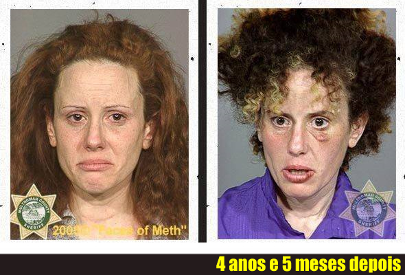 Fotos mostram como as drogas destroem a aparência física das pessoas