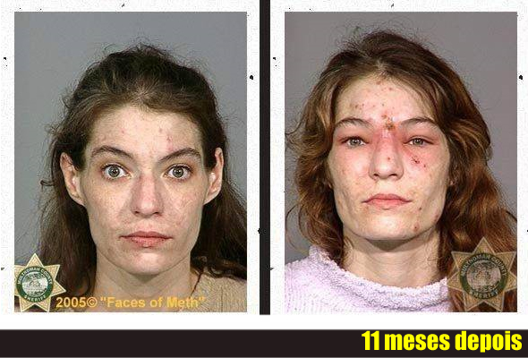 Fotos mostram como as drogas destroem a aparência física das pessoas